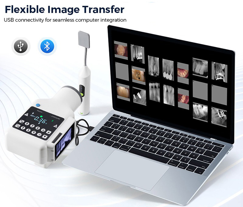 Dental Portable X-Ray Machine(Built-in Screen) + iRay Pluto 0002XW Dental Wireless X-Ray Sensor